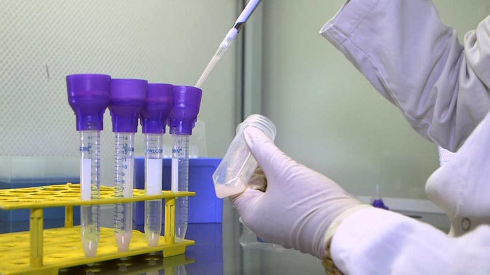 Magnetic Isolation of Microglial Cells from Neonate Mouse for Primary Cell Cultures