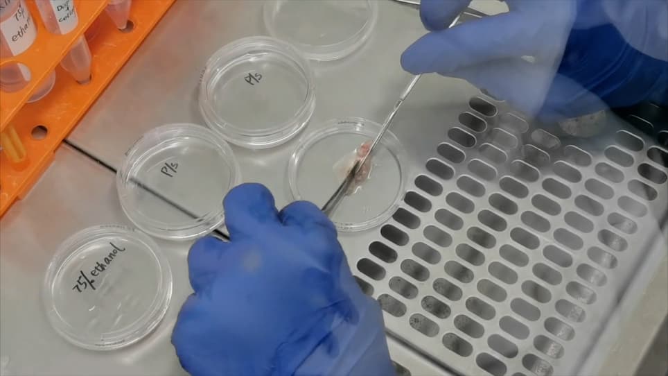 Isolation and Culture of Primary Human Gingival Epithelial Cells using Y-27632