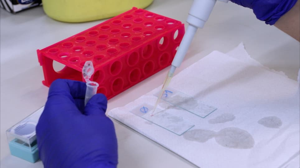 Detection of Post-Replicative Gaps Accumulation and Repair in Human Cells Using the DNA Fiber Assay