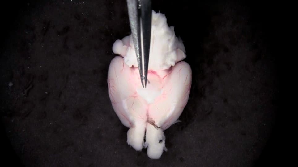 Isolation and Functional Analysis of Arteriolar Endothelium of Mouse Brain Parenchyma