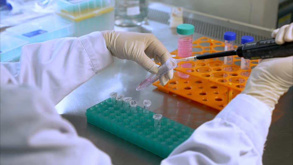 Purification of Ubiquitinated p53 Proteins from Mammalian Cells
