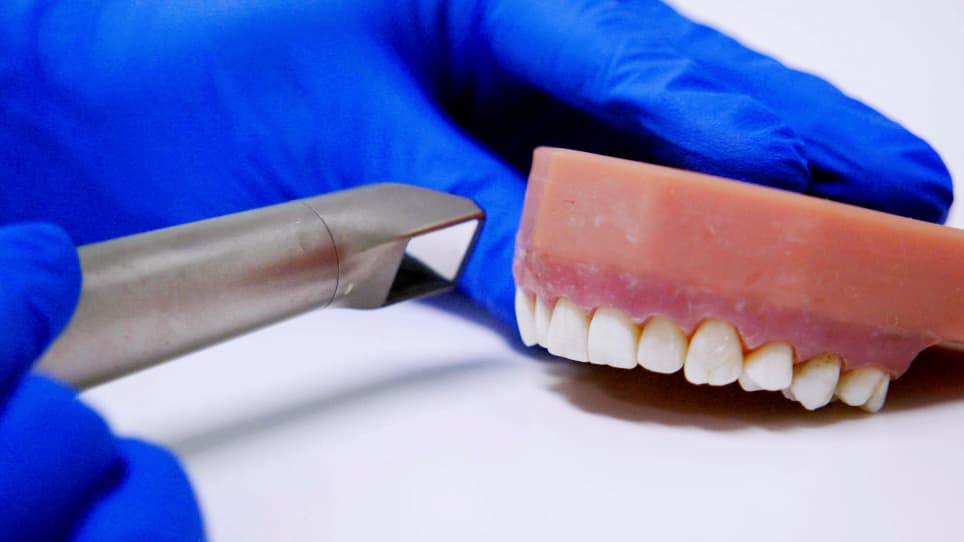 Detection and Removal of Tooth-Colored Composite Resin Using the Fluorescence-Aided Identification Technique