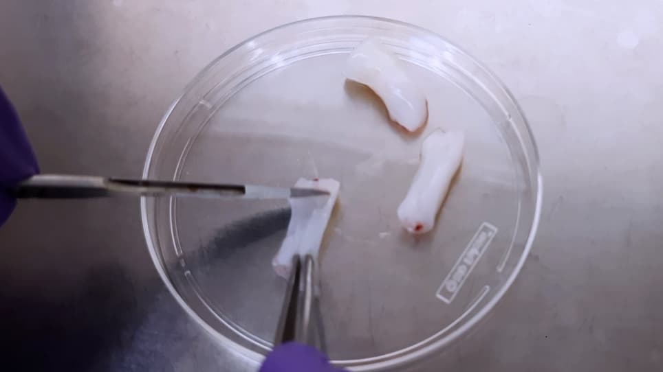 Generation of Mesenchymal Stem Cells from Human Umbilical Cord Tissue and their Differentiation into the Skeletal Muscle Lineage