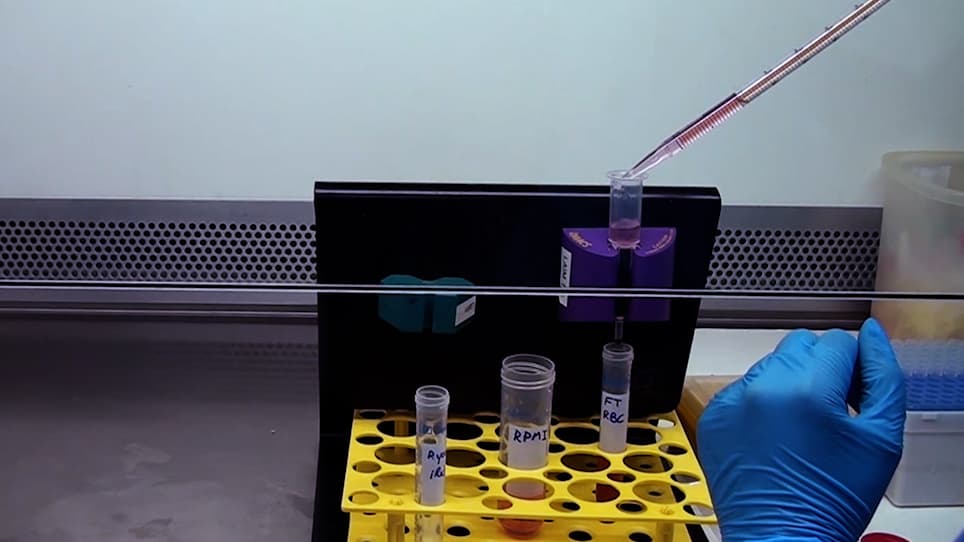 <em>In Vitro</em> Assay of <em>Plasmodium</em>-Infected Red Blood Cell Killing by Cytotoxic Lymphocytes