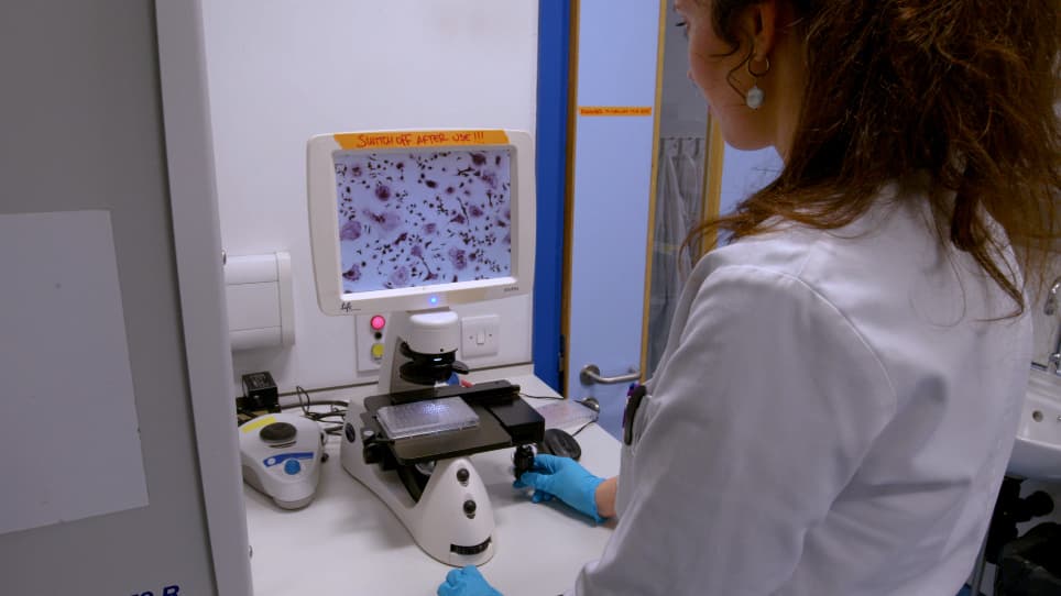 Differentiation of Functional Osteoclasts from Human Peripheral Blood CD14<sup>+</sup> Monocytes
