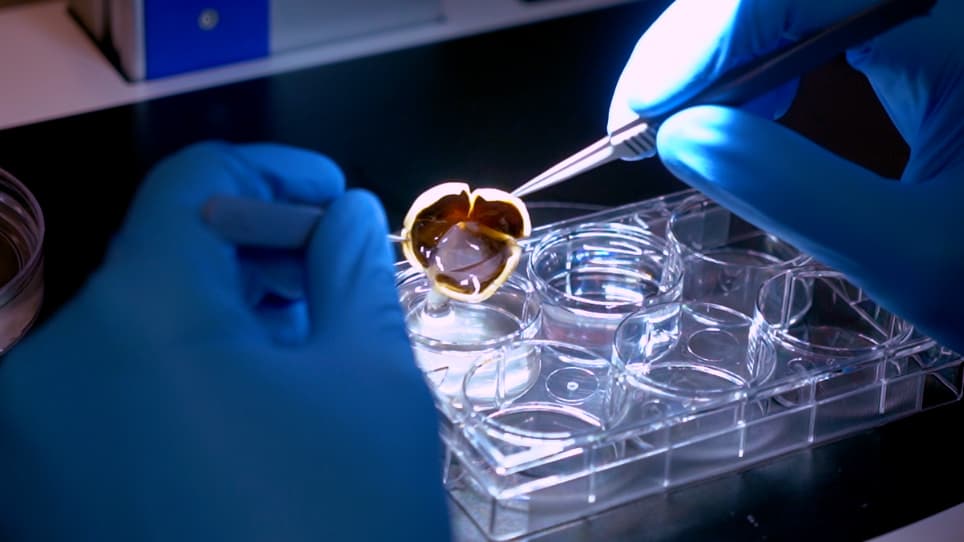 Efficient and Consistent Generation of Retinal Pigment Epithelium/Choroid Flatmounts from Human Eyes for Histological Analysis