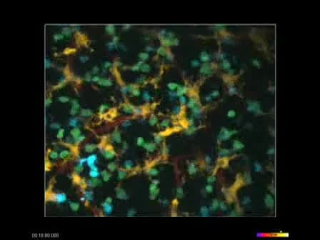 In situ Imaging of the Mouse Thymus Using 2-Photon Microscopy