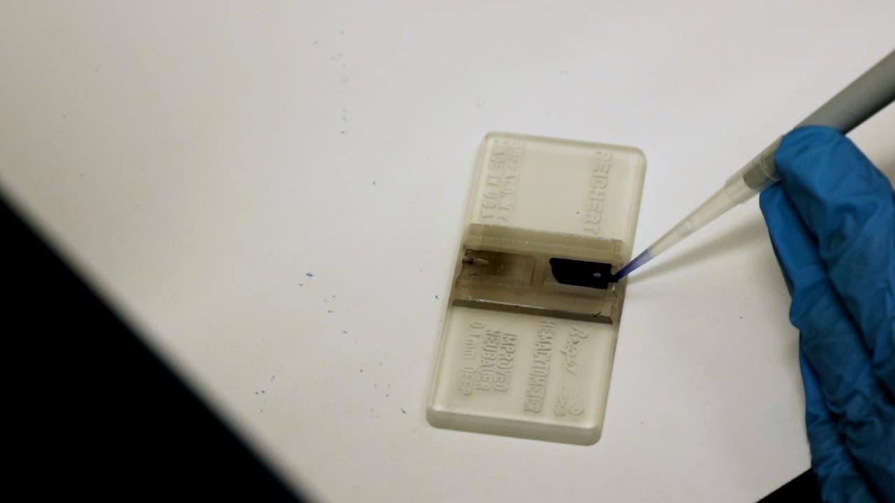 Screening Ion Channels in Cancer Cells