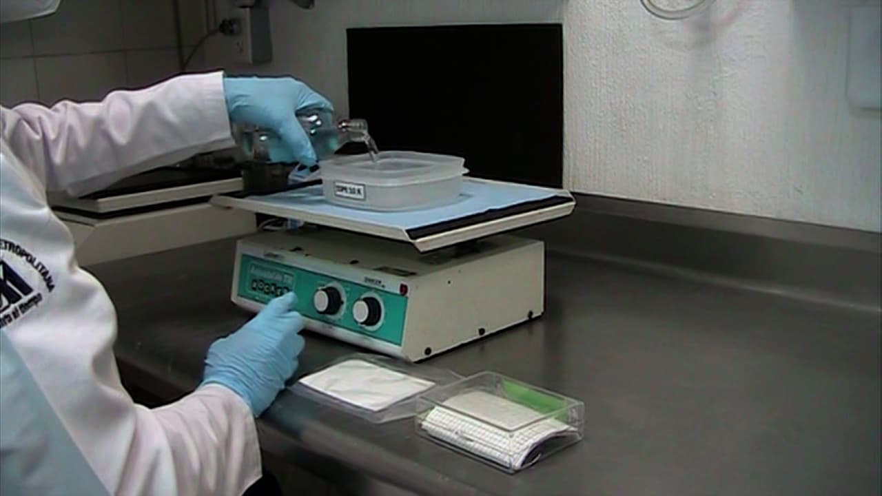 Polymerase Chain Reaction and Dot-Blot Hybridization for <i>Leptospira</i> Detection in Water Samples