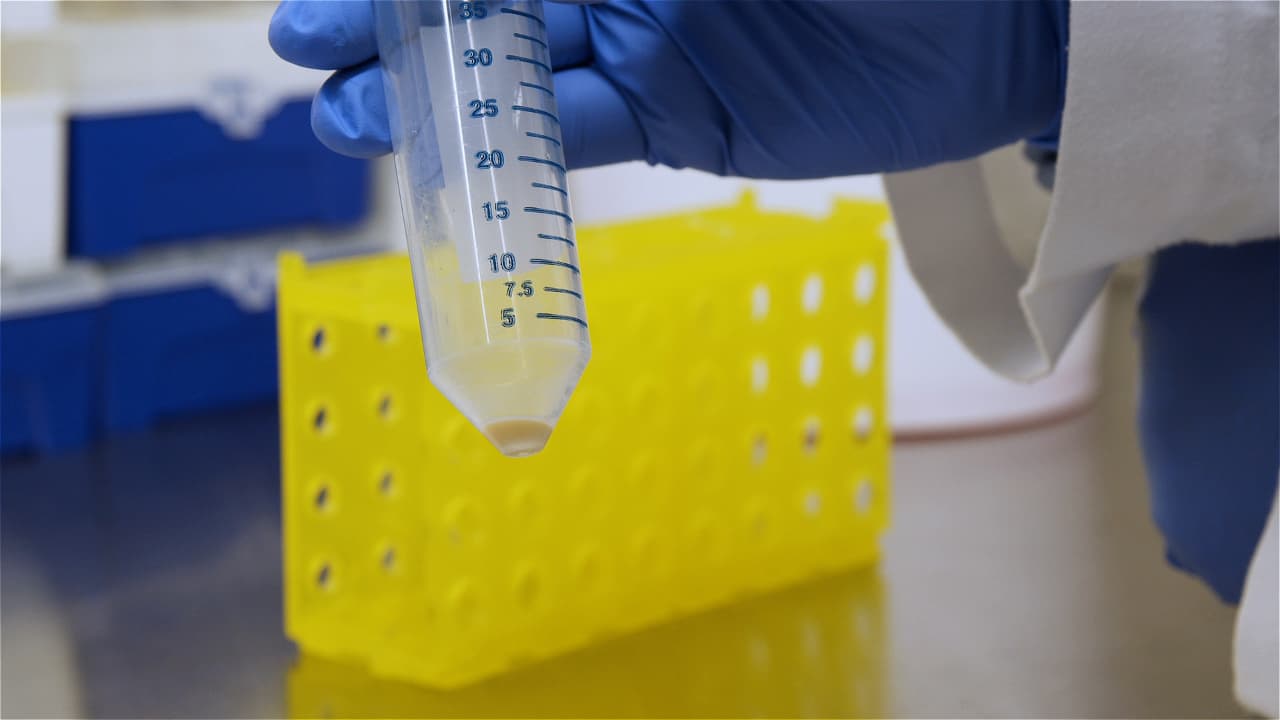 Author Spotlight: Optimizing CFU Determination for Efficient Assessment of TB Vaccine Efficacy and Antigen Presentation Analysis