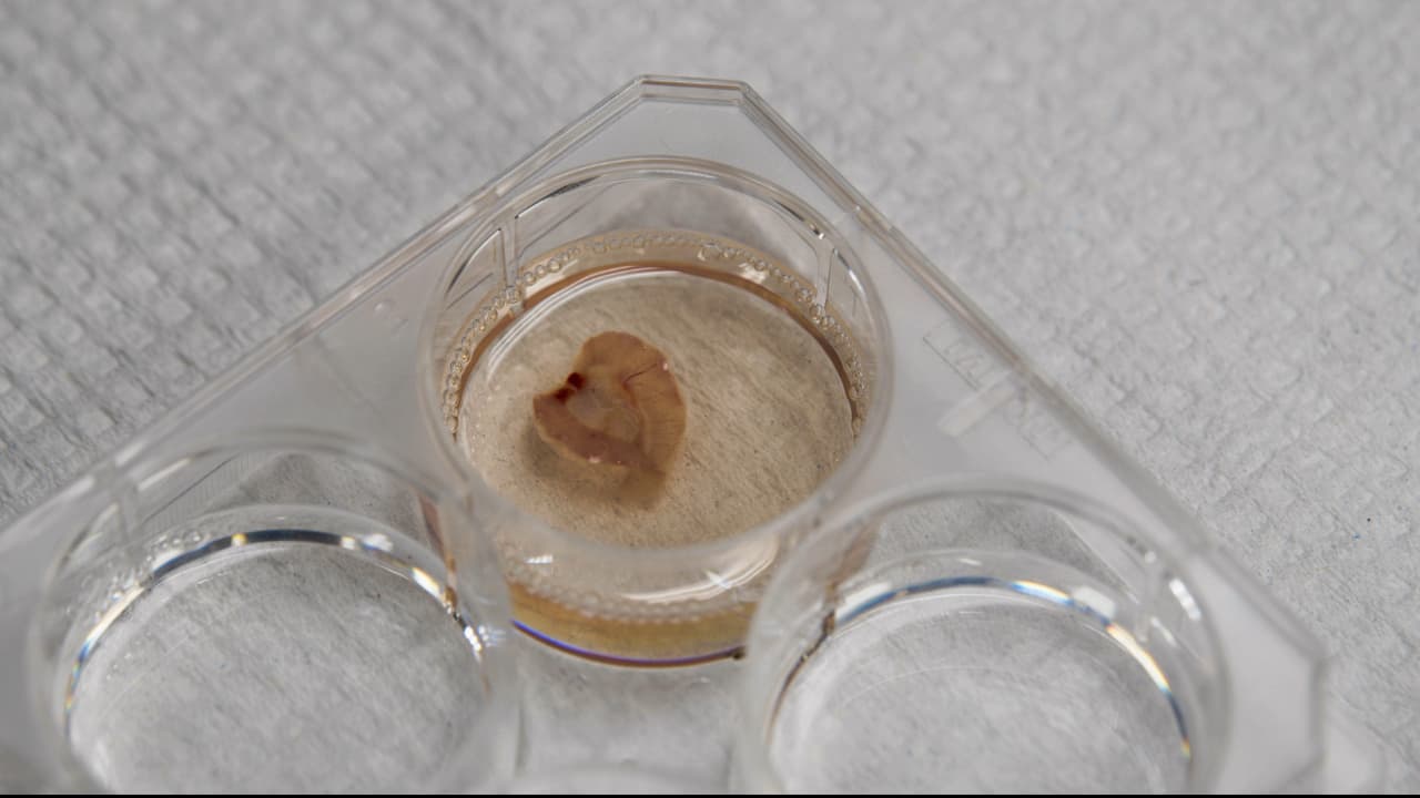 Decellularization-Based Quantification of Skeletal Muscle Fatty Infiltration