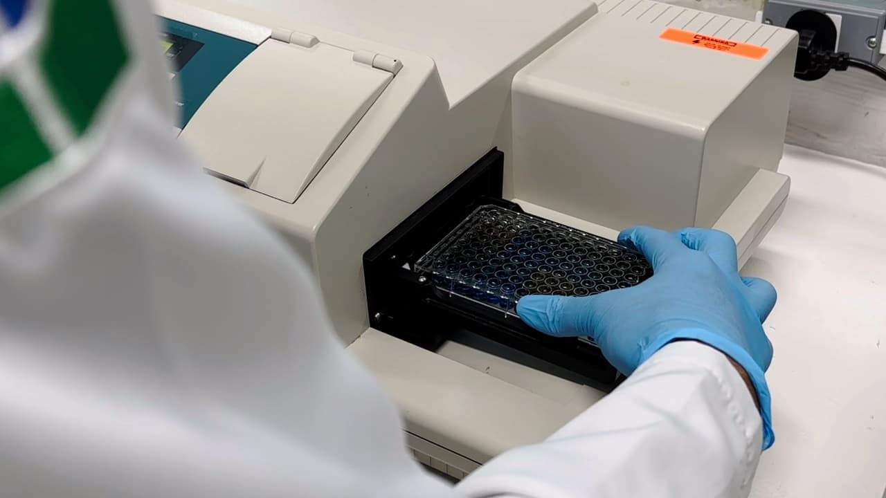 RGBradford: Protein Quantitation with a Smartphone Camera