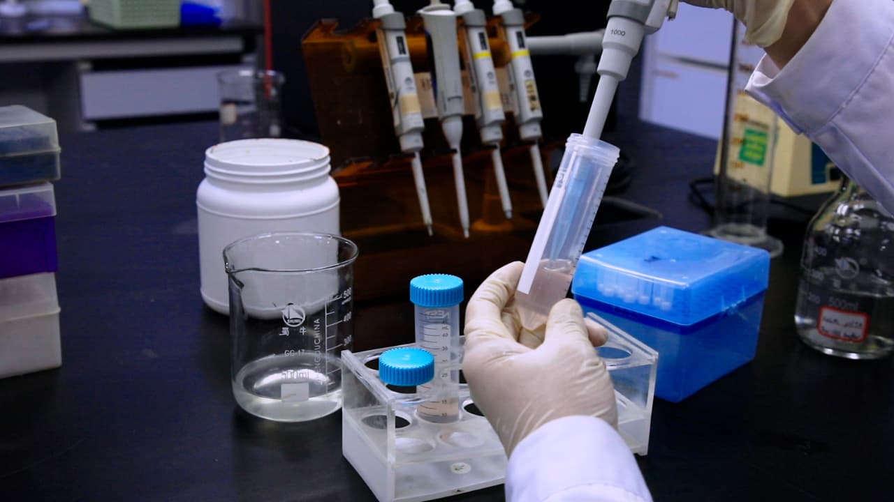 Affinity Purification of a Fibrinolytic Enzyme from <em>Sipunculus nudus</em>