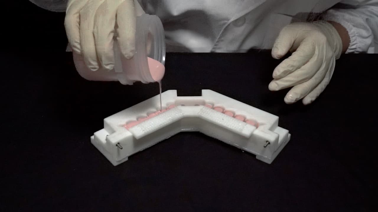 A Flexible Wearable Supernumerary Robotic Limb for Chronic Stroke Patients