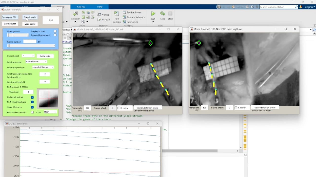Stereo-Imaging System DLT Calibration to Capture 3D In Situ Displacements of Stretched Peripheral Nerves