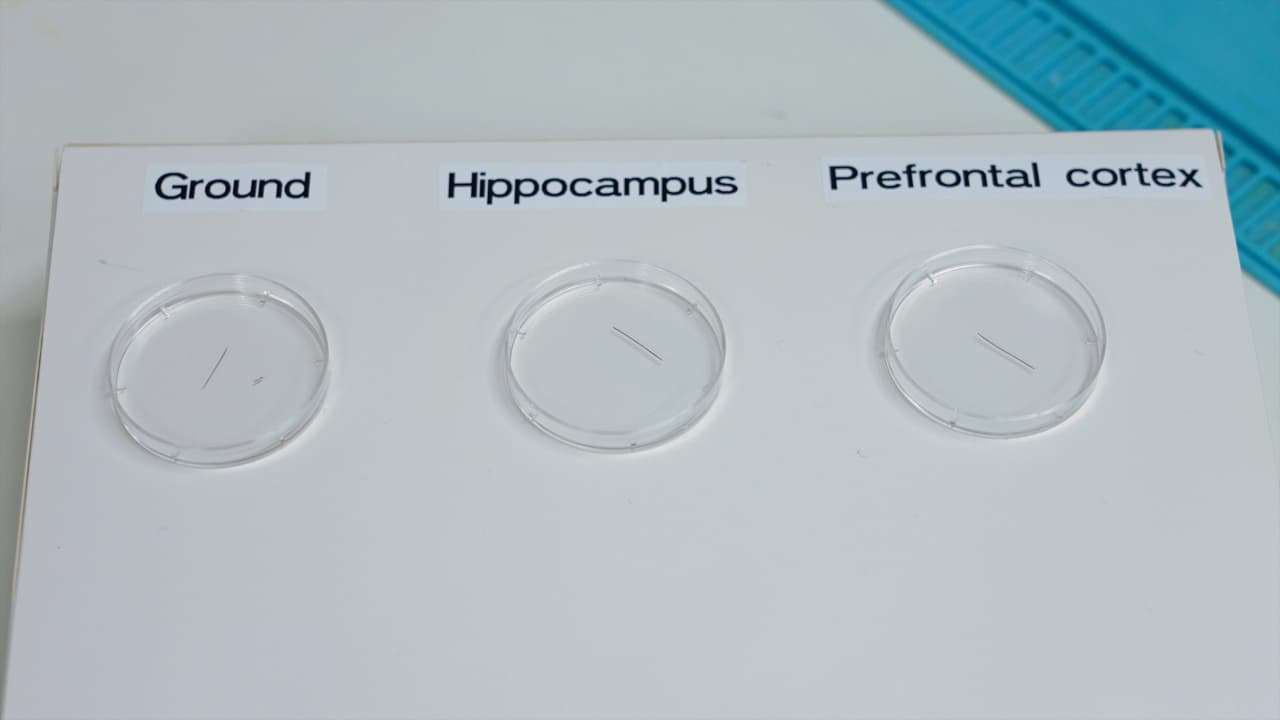 Author Spotlight: Studying Drug Impacts on Brain Signals Using Dual LFP Recording Protocol in Mice