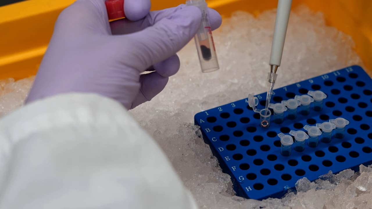 Arteriovenous Metabolomics to Measure In Vivo Metabolite Exchange in Brown Adipose Tissue