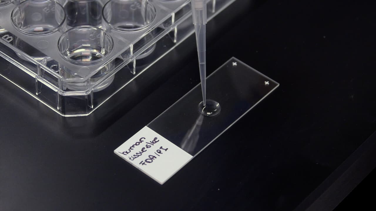 Generating Human Pancreatic Tissue Slices to Study Endocrine and Exocrine Pancreas Physiology