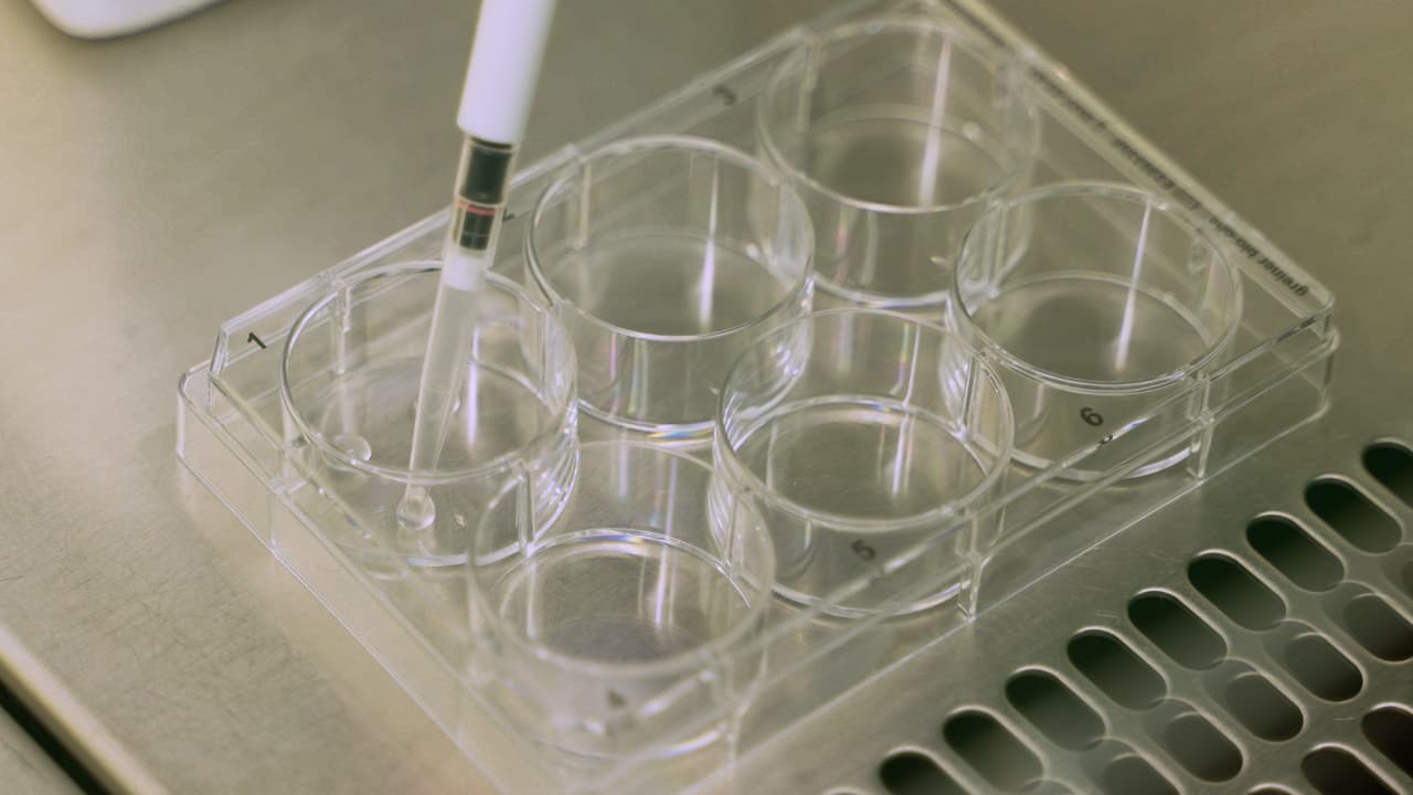 Three-Dimensional Cell Culture Models to Investigate the Epithelial Barrier in Eosinophilic Esophagitis
