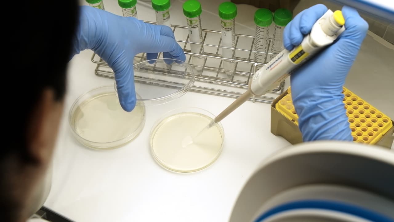 Strategies to Enhance Cultivation of Anaerobic Bacteria from Gastrointestinal Tract of Chicken