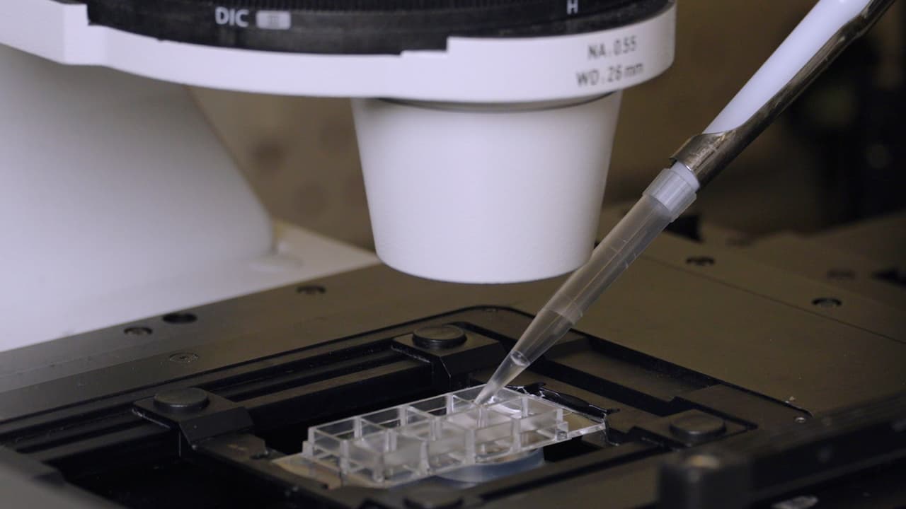 Alternative Methods for the Detection of Superoxide Anion Generation in Platelets
