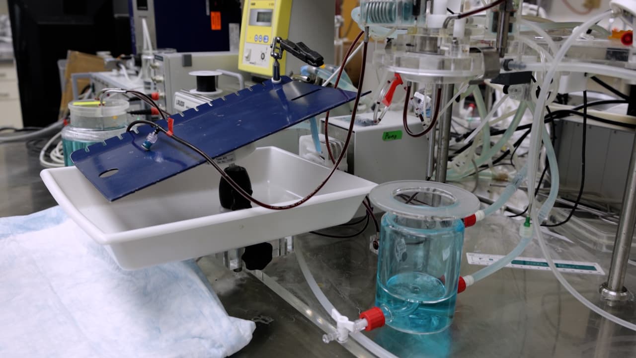 Exploring Alternative Perfusion Solutions Using Next-Generation Polymerized Hemoglobin-Based Oxygen Carriers in a Model of Rat Ex Vivo Lung Perfusion