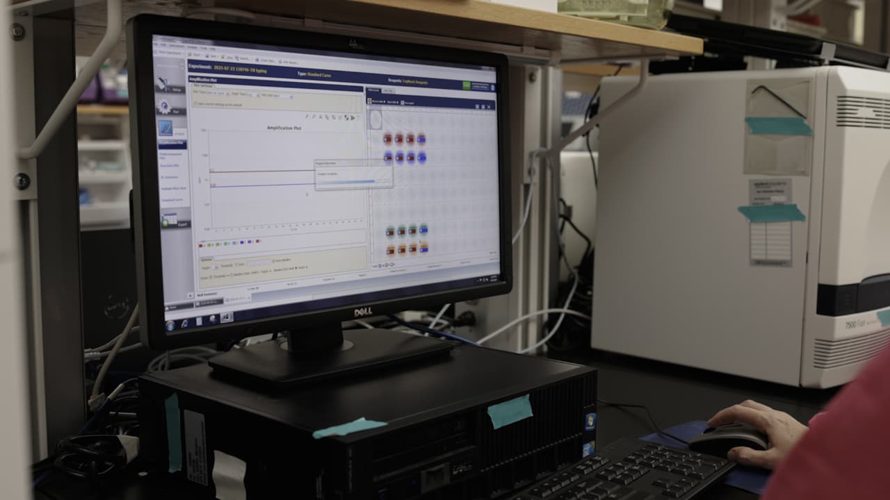 Postmortem Diagnosis of Rabies in Animals by the Updated, Multiplexed LN34 Real-Time Reverse Transcription-Polymerase Chain Reaction Assay