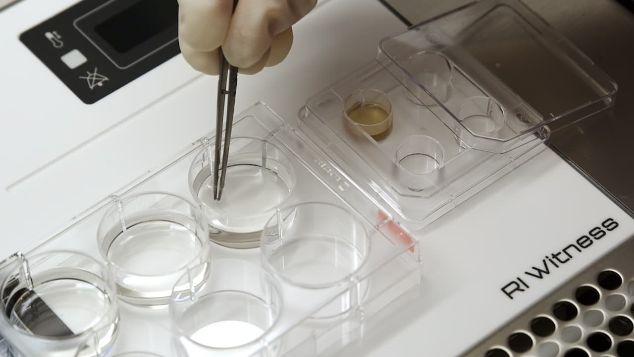 Vitrification of Ovarian Cortex Tissue to Achieve a Glassy State of Aggregation