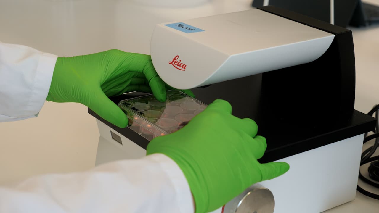 Author Spotlight: Standardizing Spheroid Formation Methods for Metabolic and Oxygenation Analysis Using Fluorescence Lifetime Imaging Microscopy