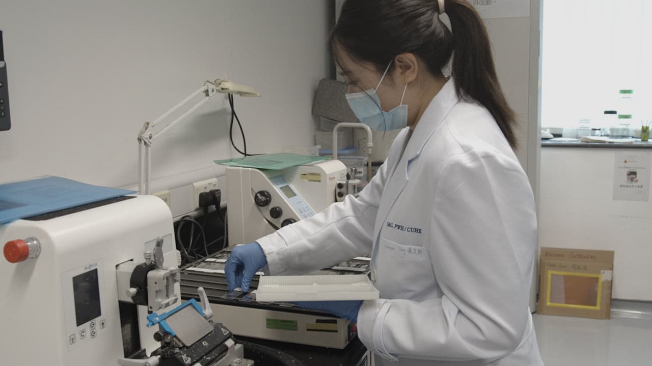 Measurement of Four Uterine NK Cell Subtypes Using Multiplexed Fluorescent Immunohistochemical Staining in Women with Repeated Implantation Failure