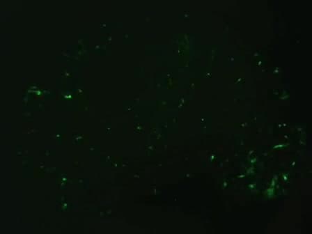 Preparation of Gene Gun Bullets and Biolistic Transfection of Neurons in Slice Culture
