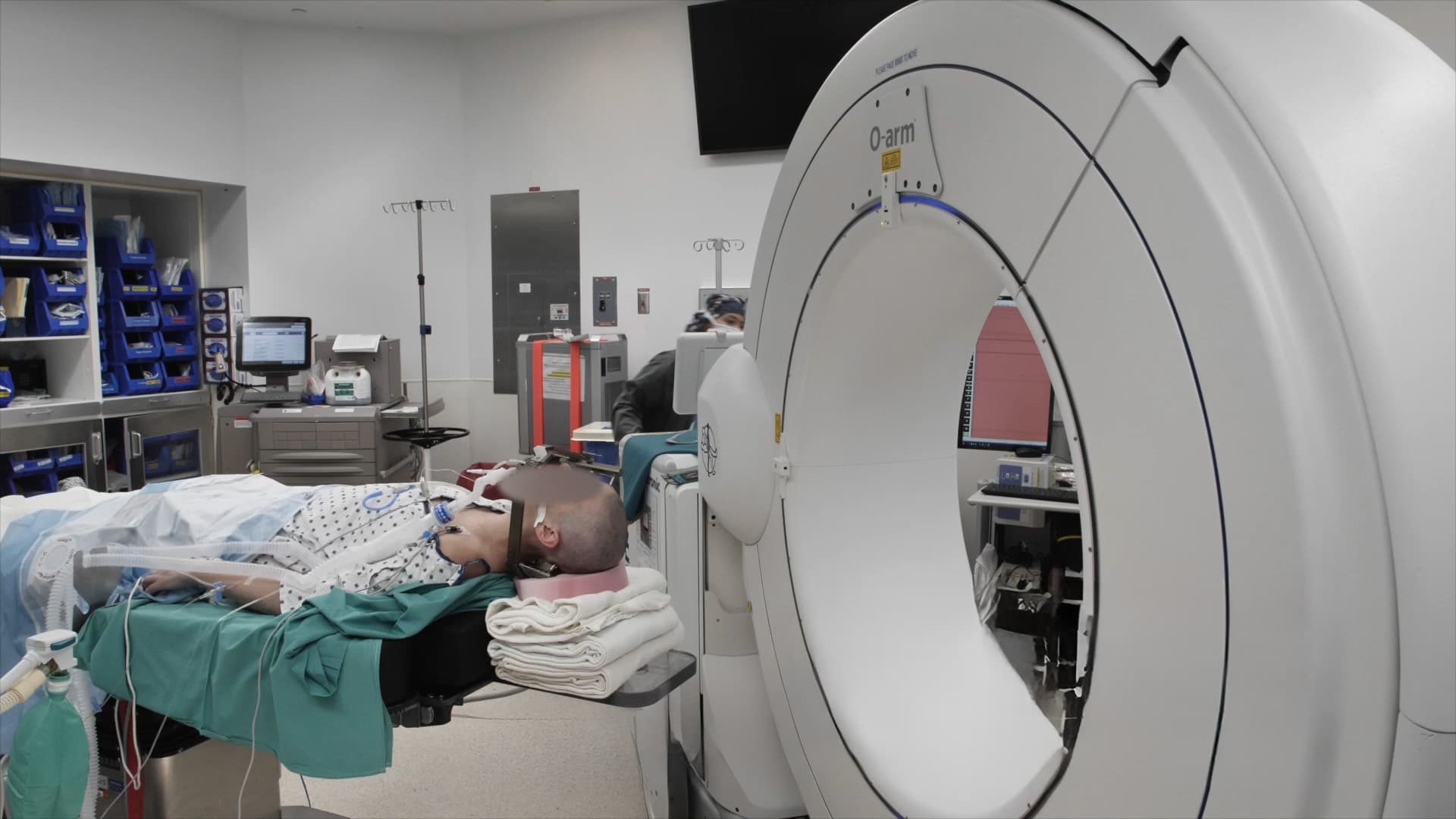 Robotic-Guided Stereoelectroencephalography for Invasive Epilepsy Monitoring
