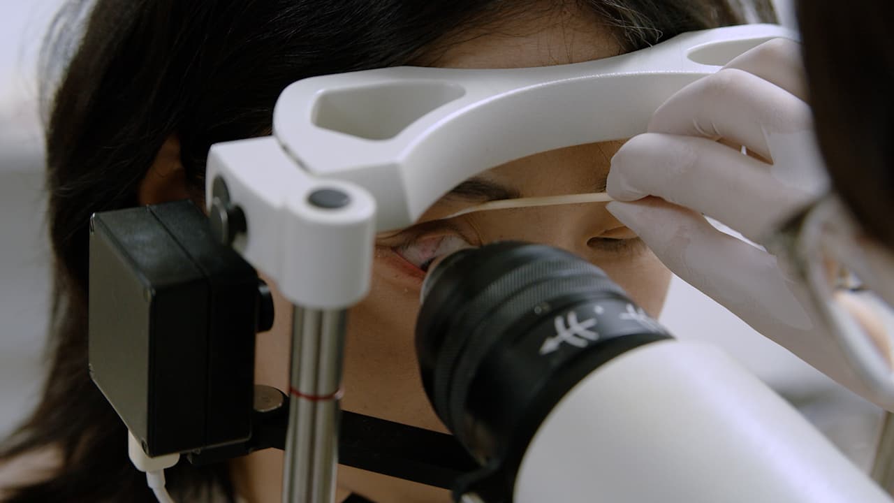 In Vivo Confocal Microscopy: A Standard Operating Procedure for the Detection of Demodex Mites at the Eyelid Margin