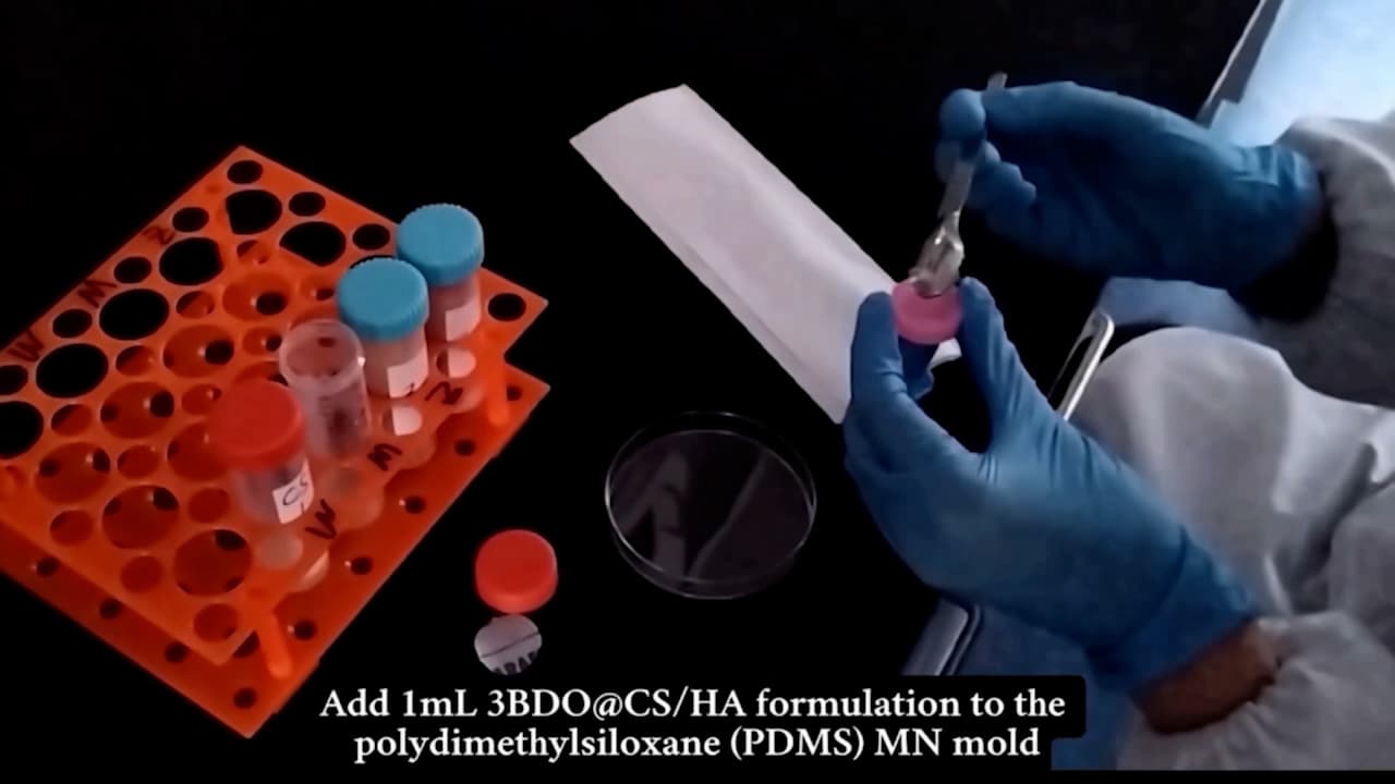Fabrication and Characterization of 3BDO-Loaded Dissolvable Microneedle Patches for Hair Regrowth in C57BL/6 Mice