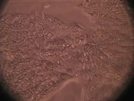 Trypsinizing and Subculturing Mammalian Cells