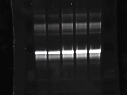 Electrophoretic Separation of Proteins