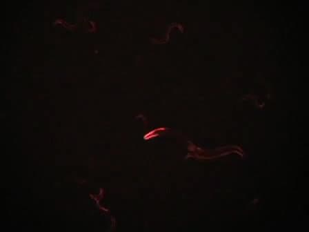 Generation of Stable Transgenic C. elegans Using Microinjection