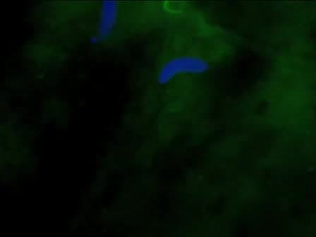 In Vitro Nuclear Assembly Using Fractionated Xenopus Egg Extracts