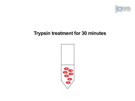 Protocol for Culturing Sympathetic Neurons from Rat Superior Cervical Ganglia SCG