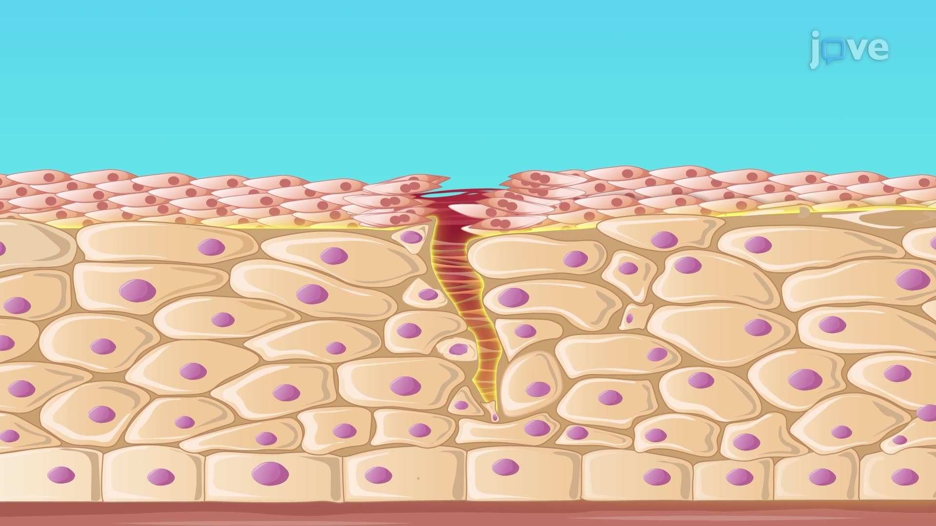 Abnormal Cell Divisions