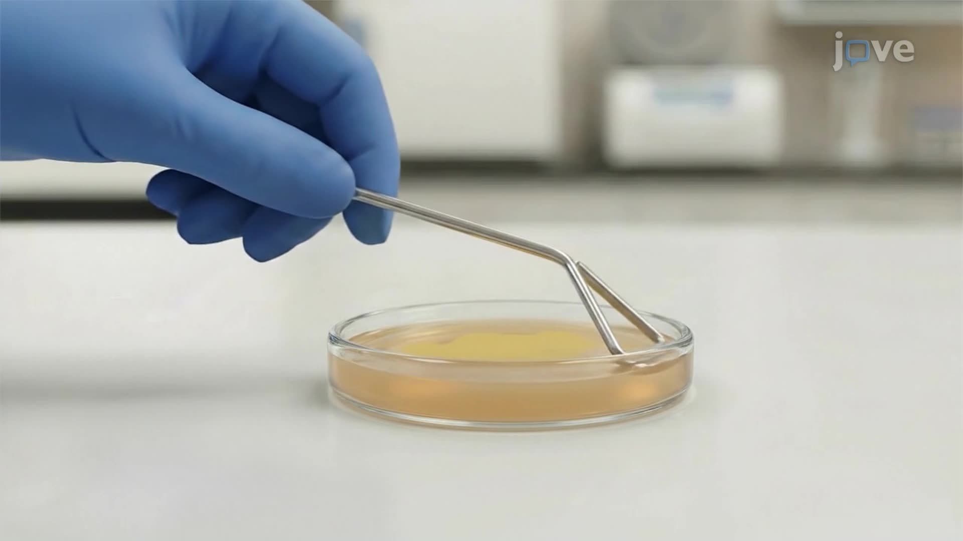Bacterial Transformation