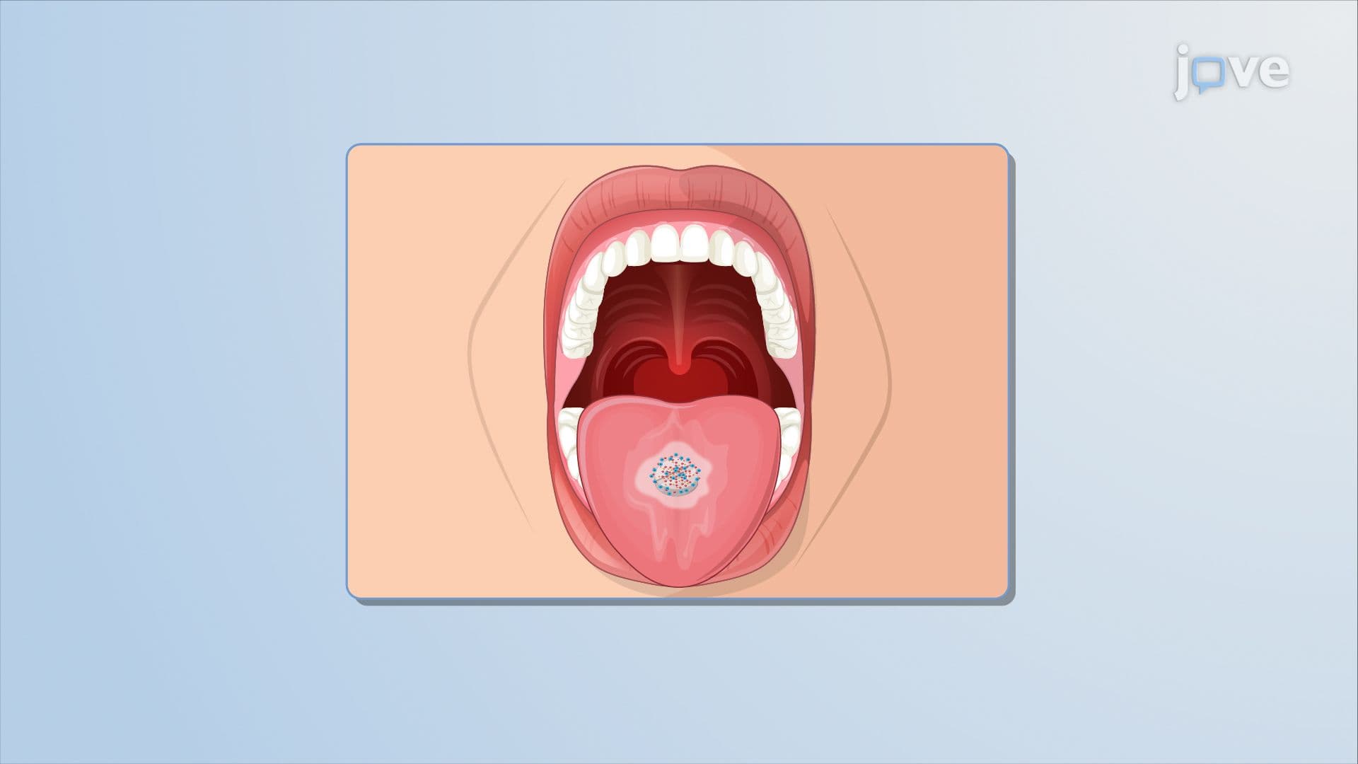 Drug Delivery Systems: Different Types