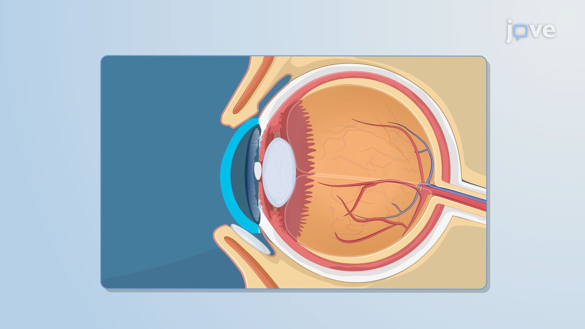 Ophthalmic Drug Delivery Systems