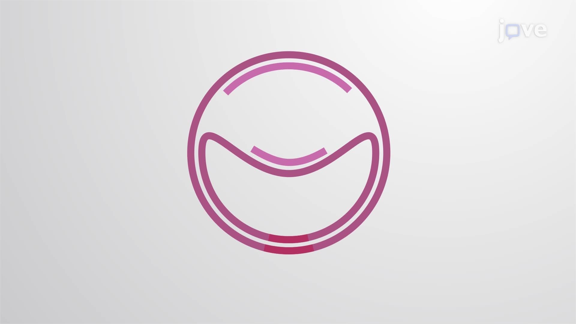 Prokaryotic DNA Replication