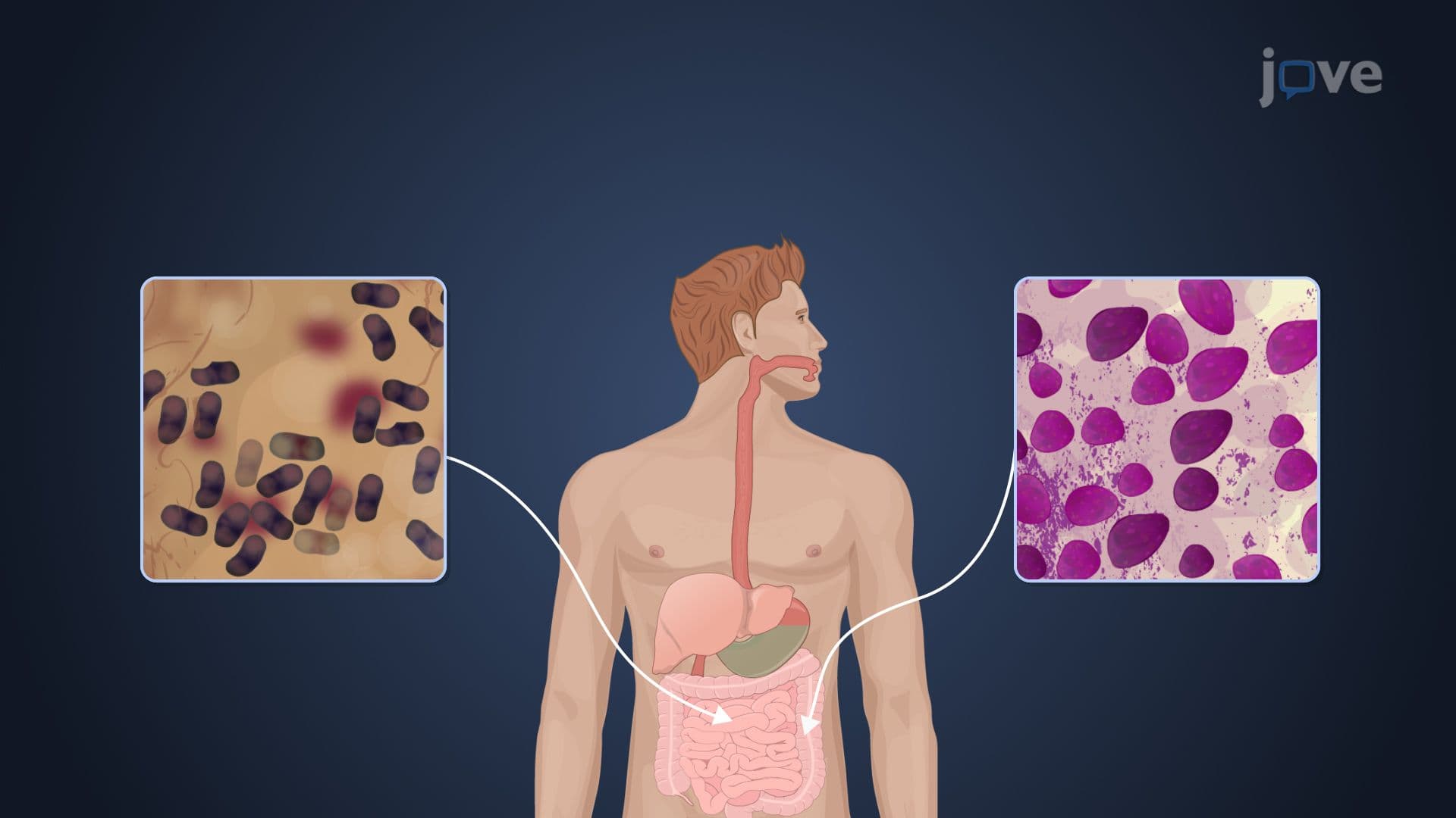 Fungal Phylum Microsporidia