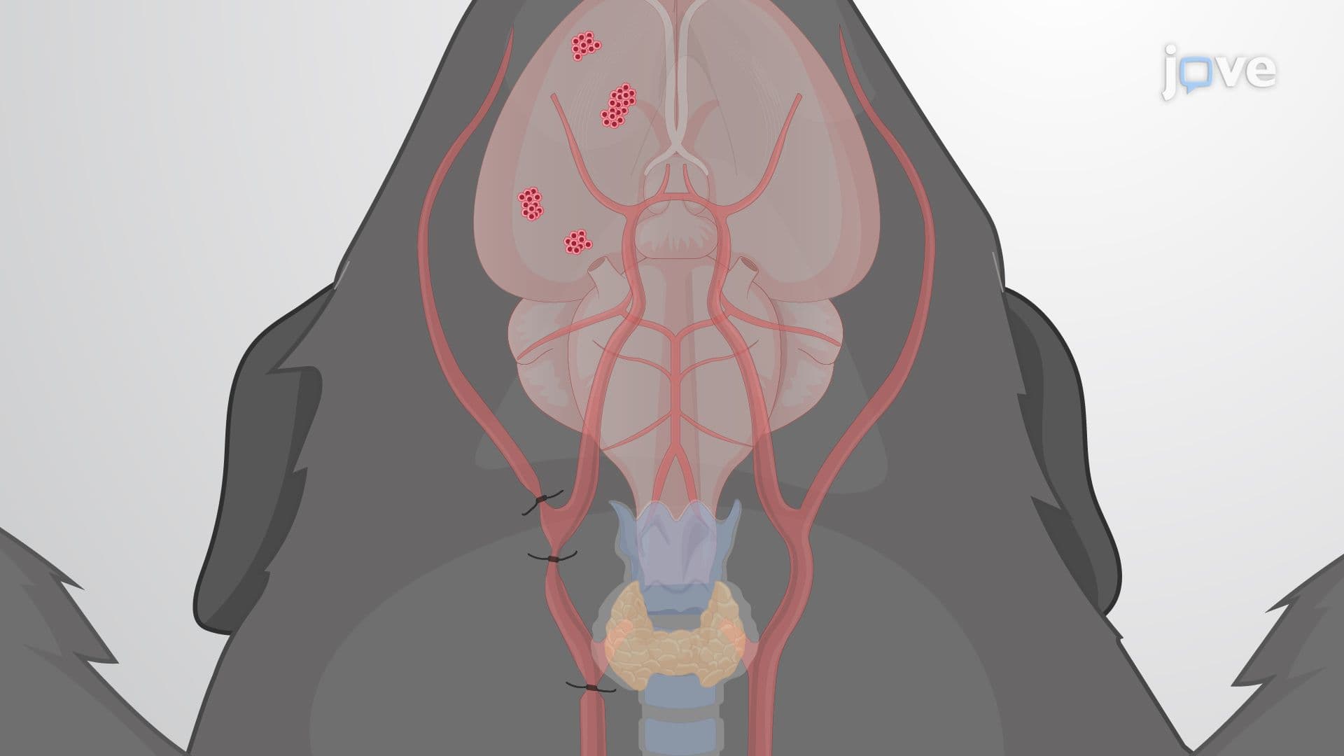 Modeling Brain Tumor Metastasis via Internal Carotid Artery Injection of Cancer Cells