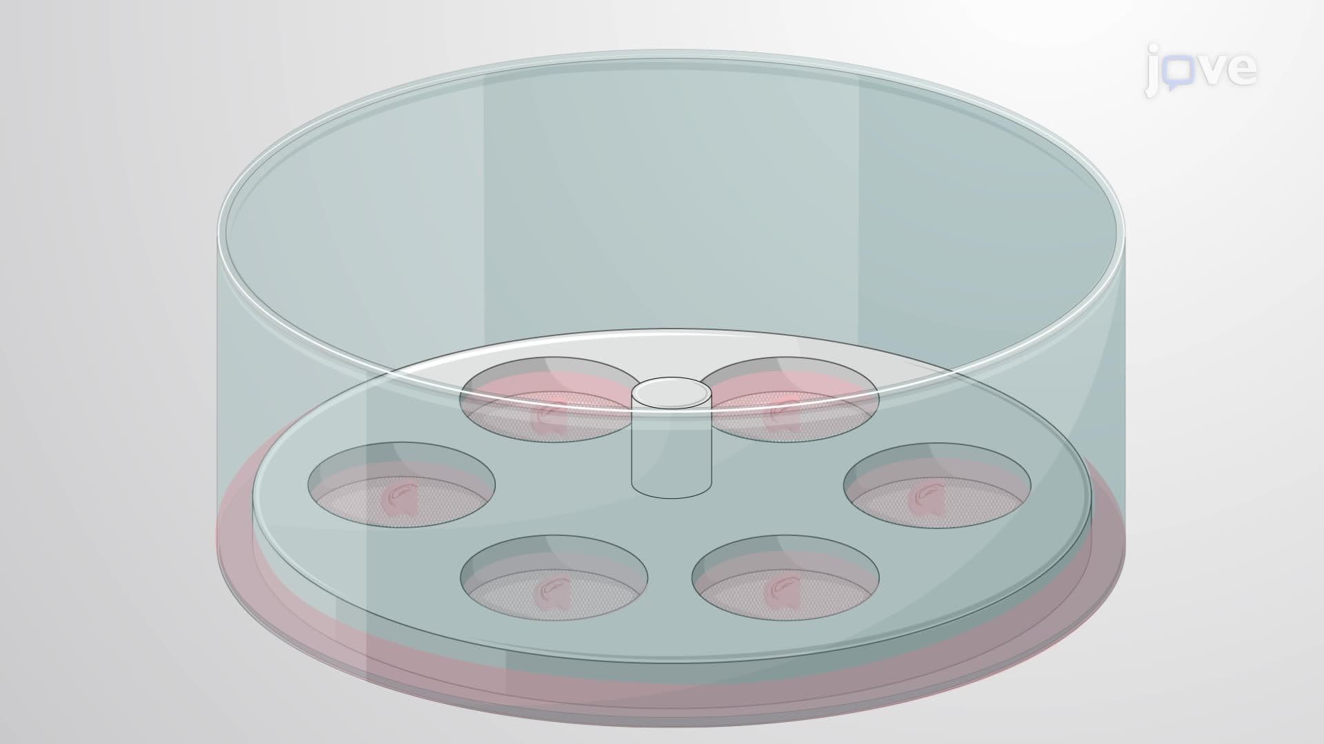 Quantifying Newly Generated Neurons in Rat Brain Tissue Using the Optical Fractionator Technique