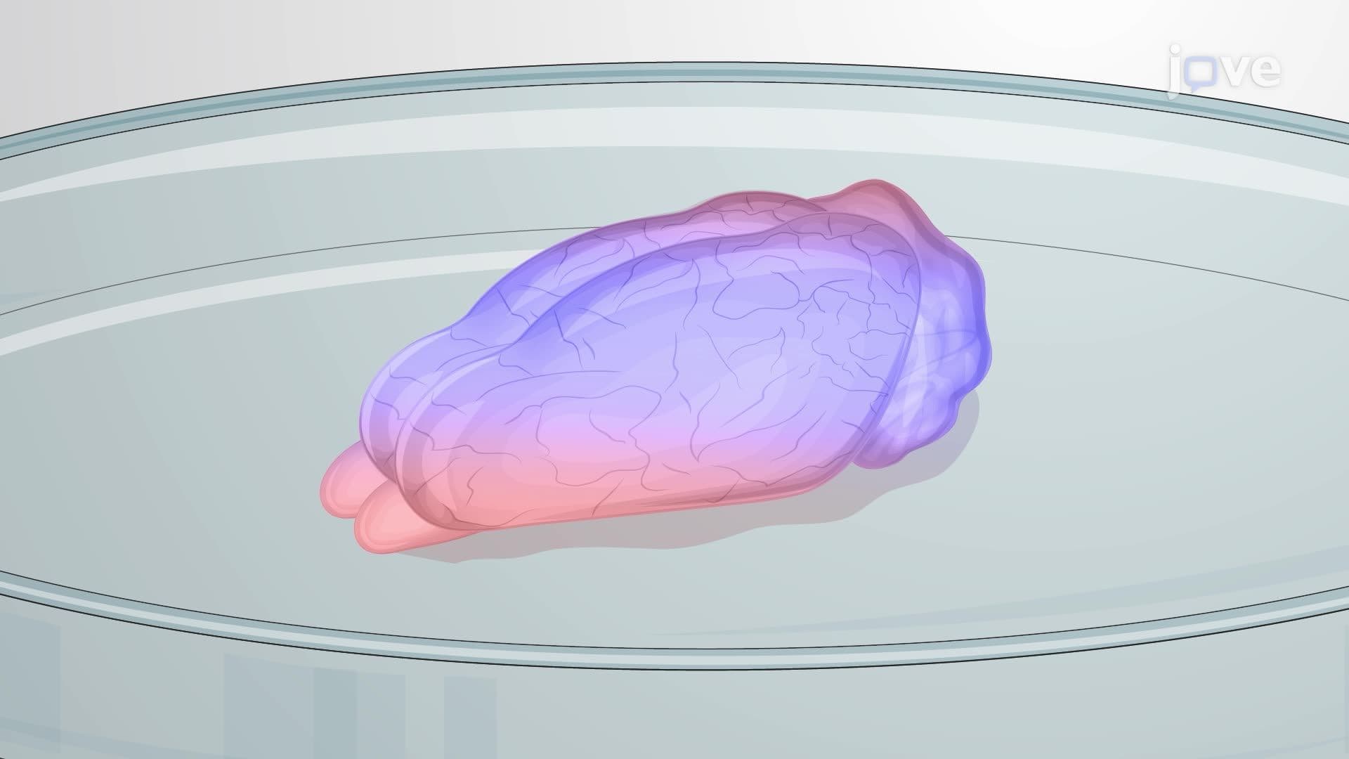 Magnetic Resonance Elastography for Assessing Viscoelastic Properties