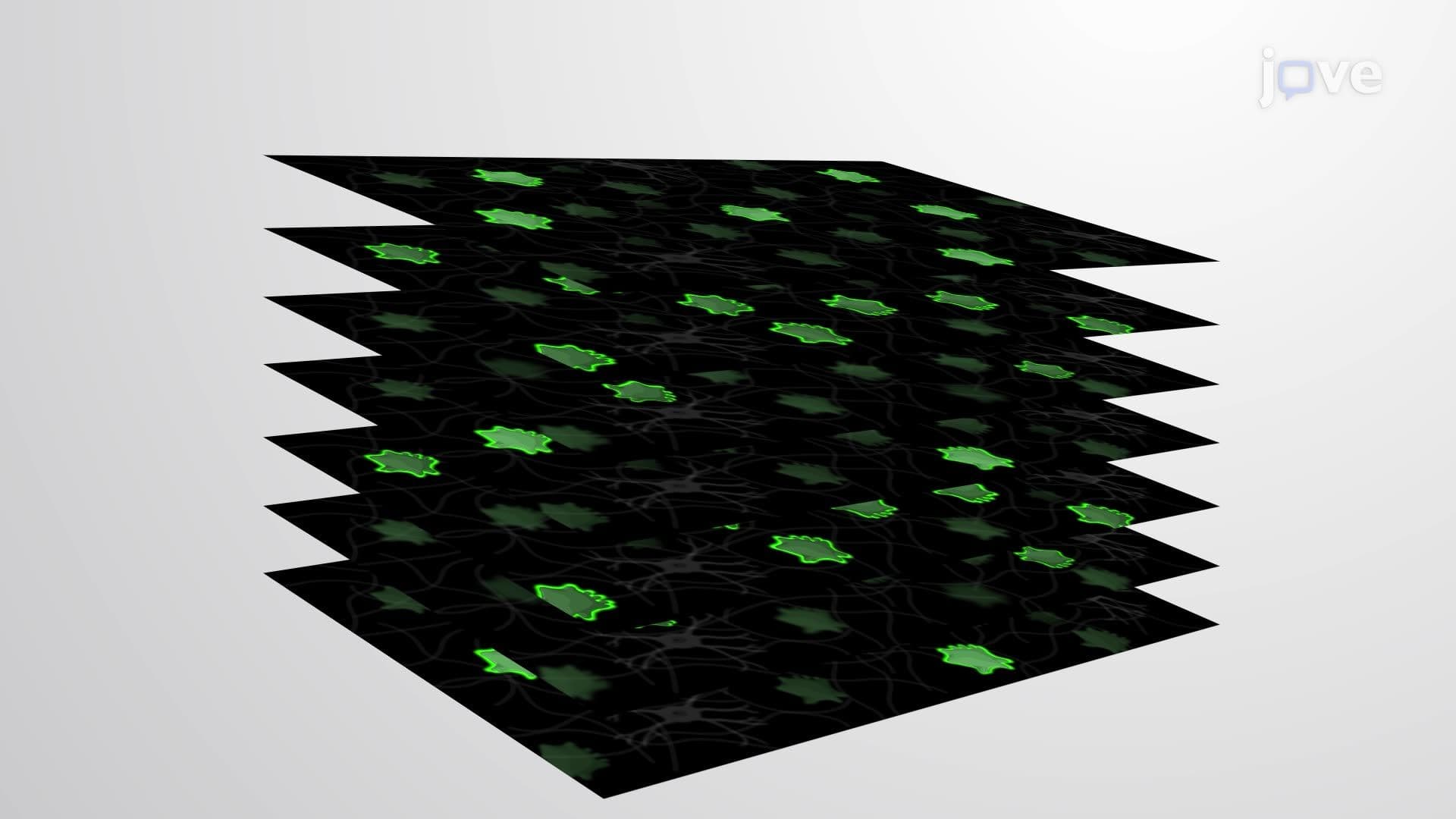 Imaging Tumor Cell Migration in Glioblastoma Tissue Using Time-Lapse Scanning Confocal Microscopy