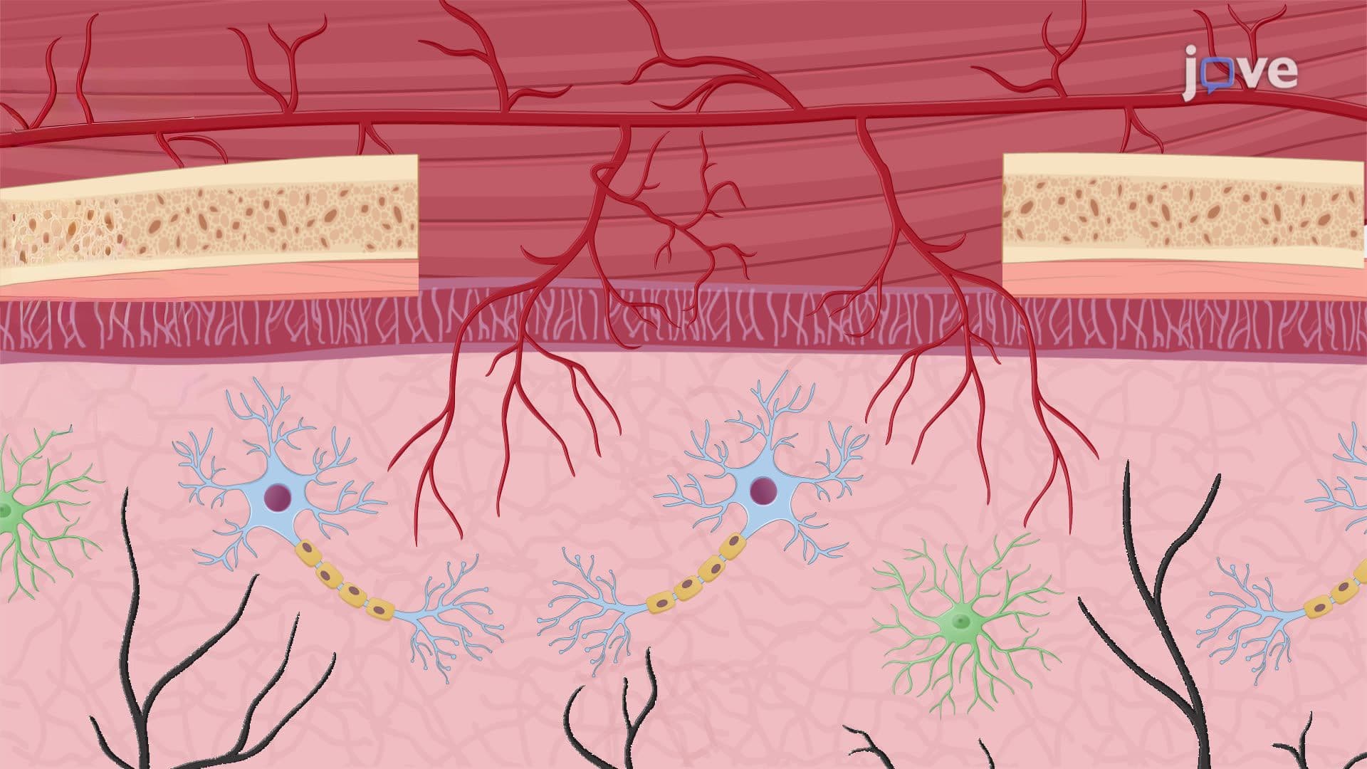 Muscle Grafting as a Surgical Strategy for Restoring Blood Flow to the Mouse Brain After Stroke